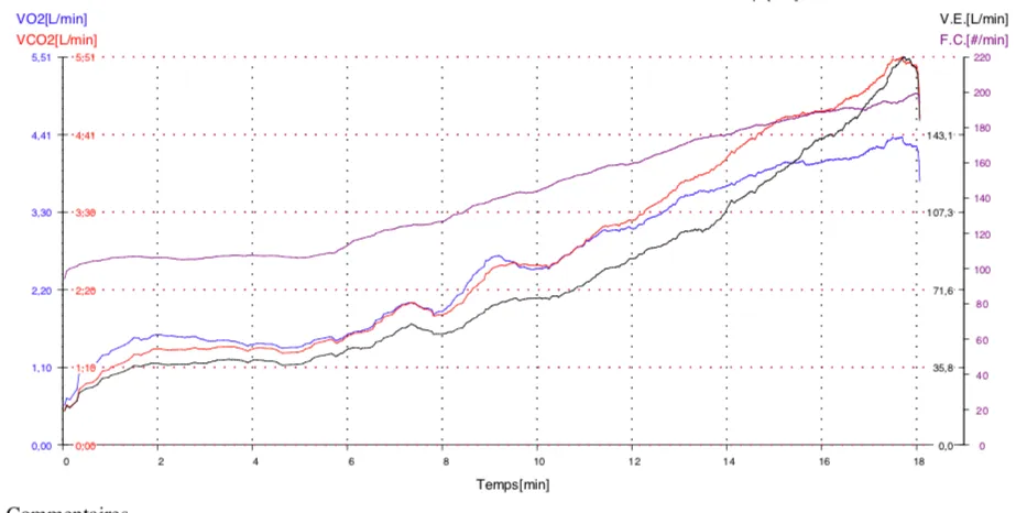 Courbes obtenues lors d'un test VO2max